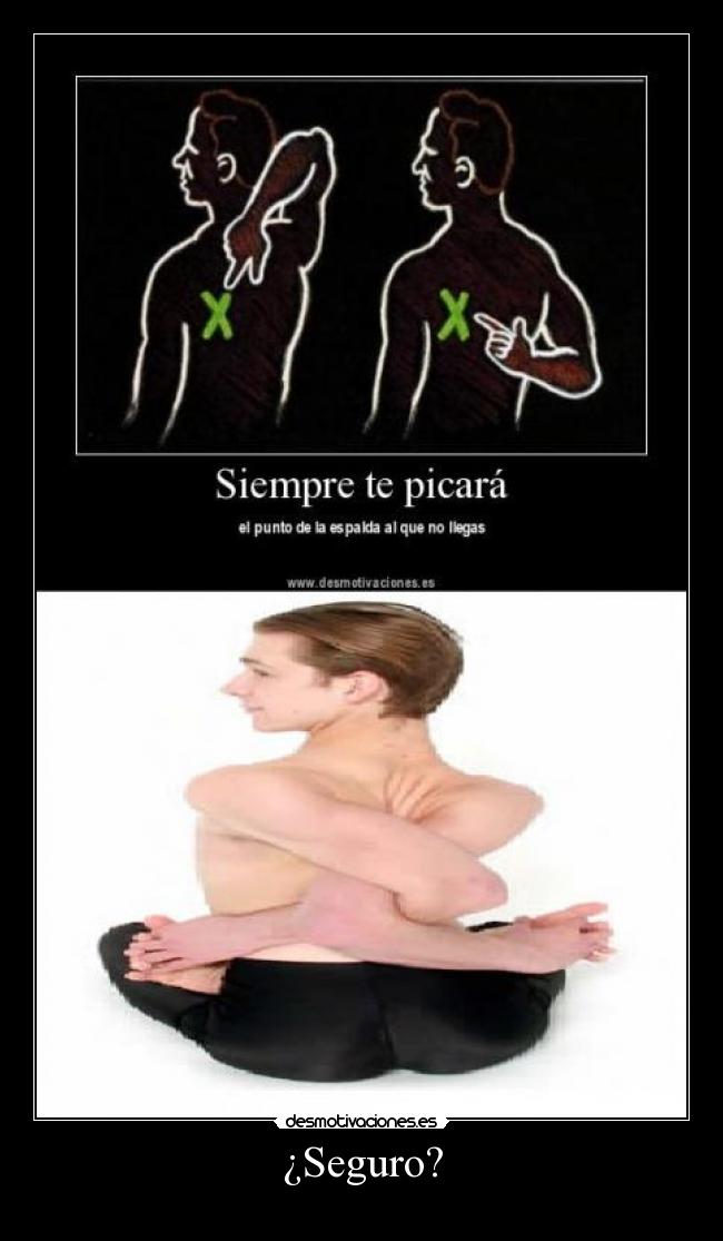 ¿Seguro? - 