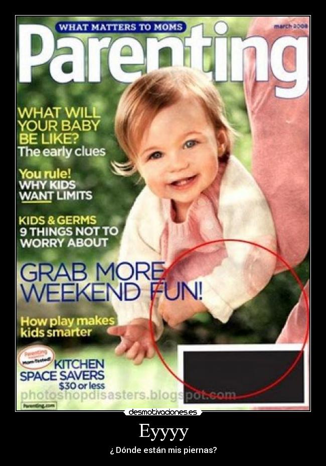 Eyyyy - ¿ Dónde están mis piernas?