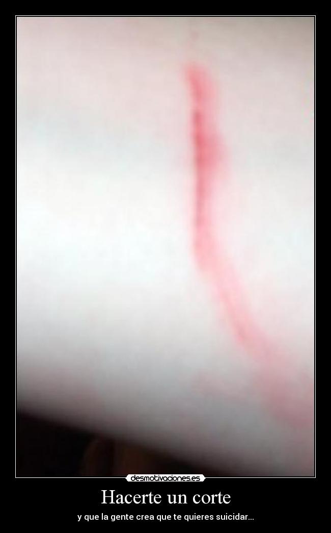 Hacerte un corte - y que la gente crea que te quieres suicidar...
