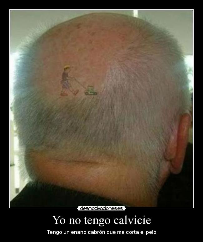 Yo no tengo calvicie - 