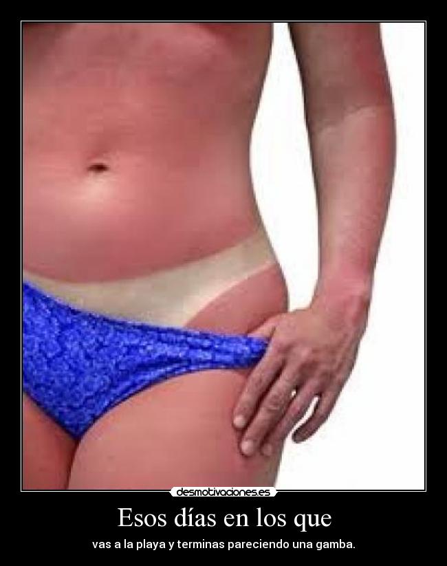 Esos días en los que - 