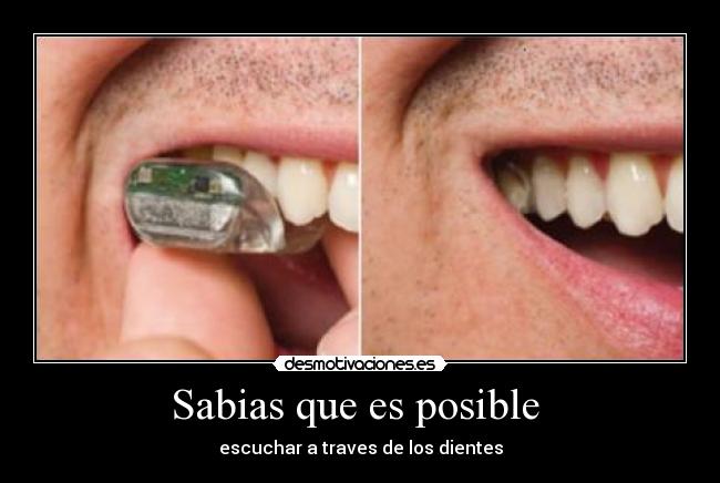 Sabias que es posible  - escuchar a traves de los dientes