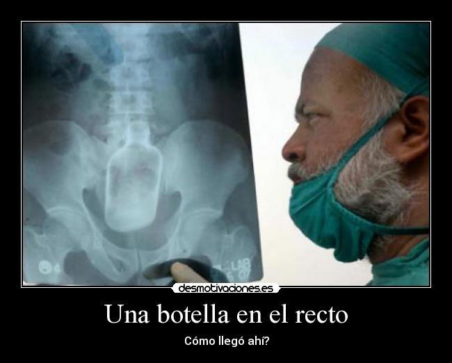 Una botella en el recto -