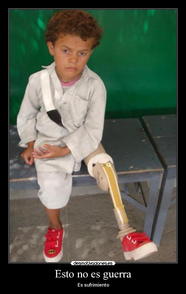 Esto no es guerra -