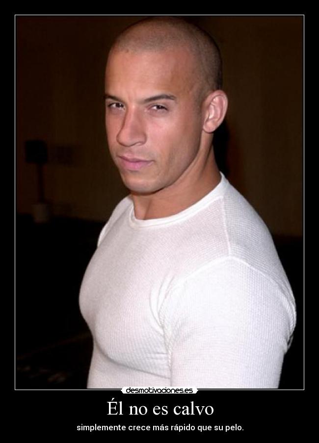 Él no es calvo - simplemente crece más rápido que su pelo.