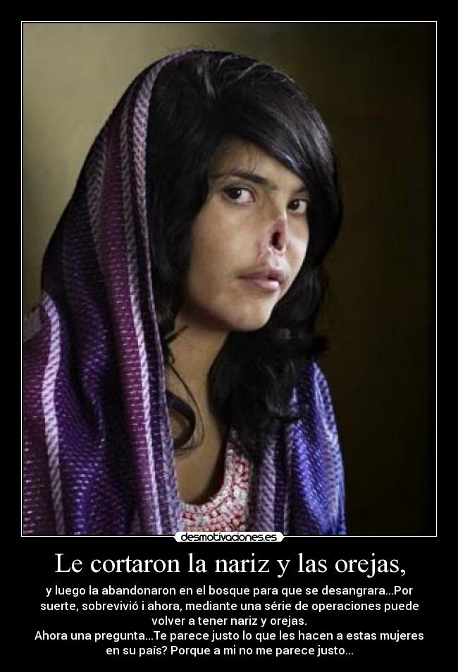 Le cortaron la nariz y las orejas, - y luego la abandonaron en el bosque para que se desangrara...Por
suerte, sobrevivió i ahora, mediante una série de operaciones puede
volver a tener nariz y orejas.
Ahora una pregunta...Te parece justo lo que les hacen a estas mujeres
en su país? Porque a mi no me parece justo...