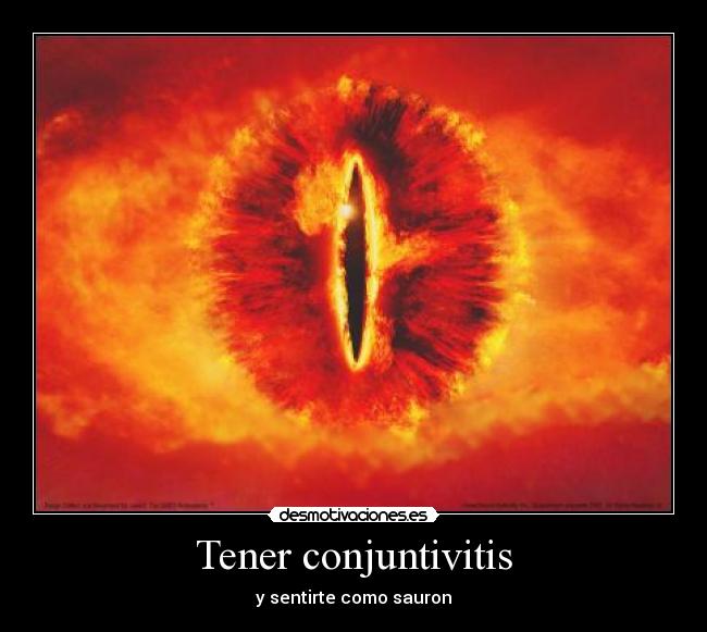 Tener conjuntivitis -