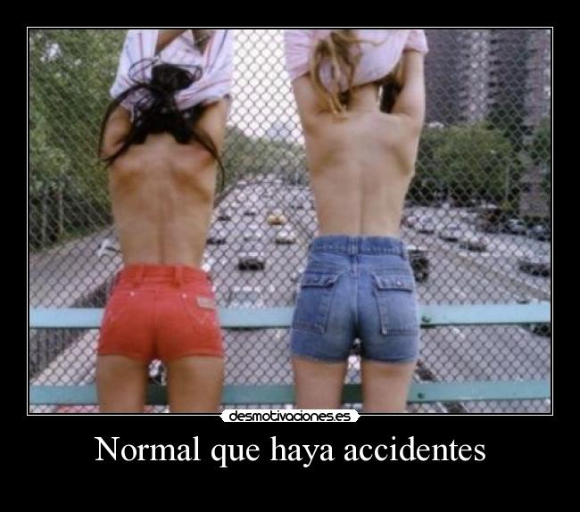 Normal que haya accidentes - 