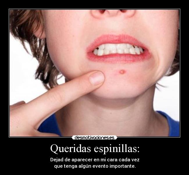 Queridas espinillas: - Dejad de aparecer en mi cara cada vez
que tenga algún evento importante.