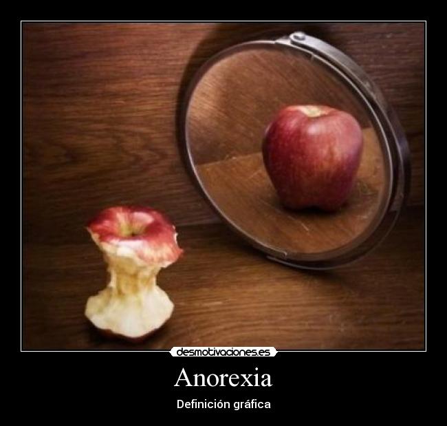 Anorexia -