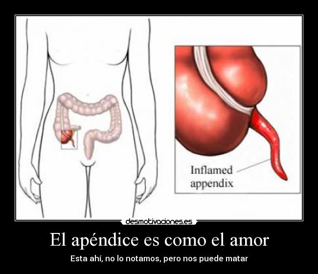 El apéndice es como el amor - 