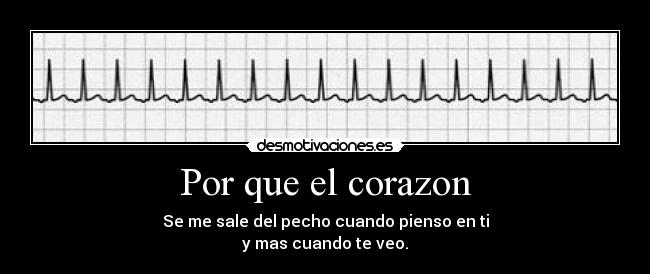 Por que el corazon - 