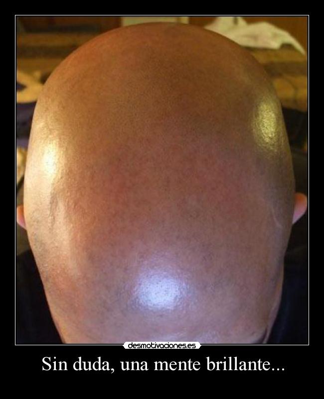 Sin duda, una mente brillante... -