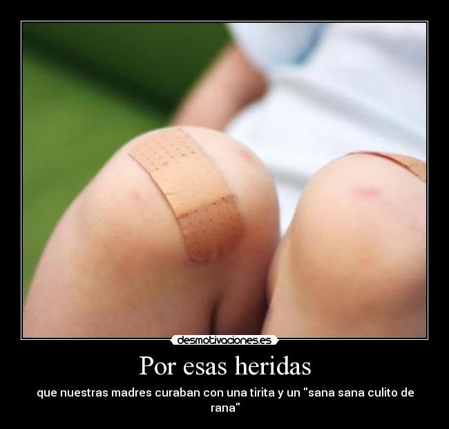 Por esas heridas -
