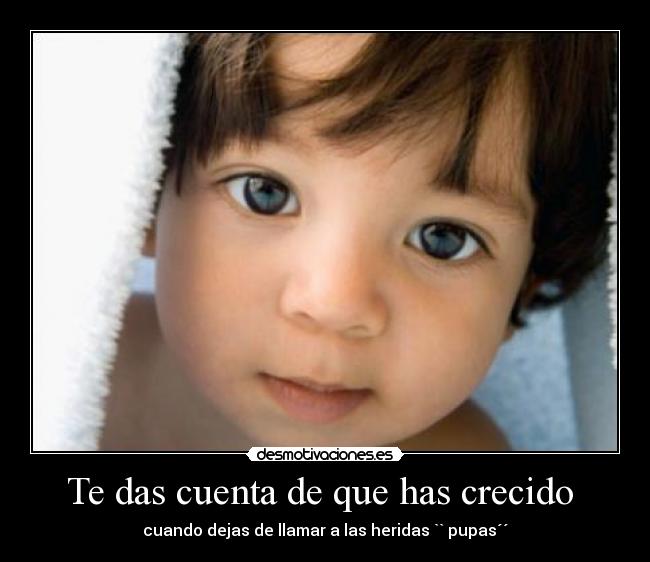 Te das cuenta de que has crecido - cuando dejas de llamar a las heridas `` pupas´´