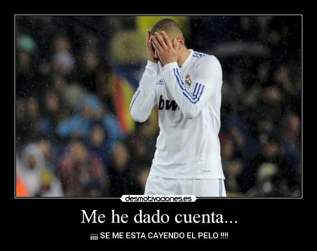 carteles benzema pelo calvo futbol desmotivaciones