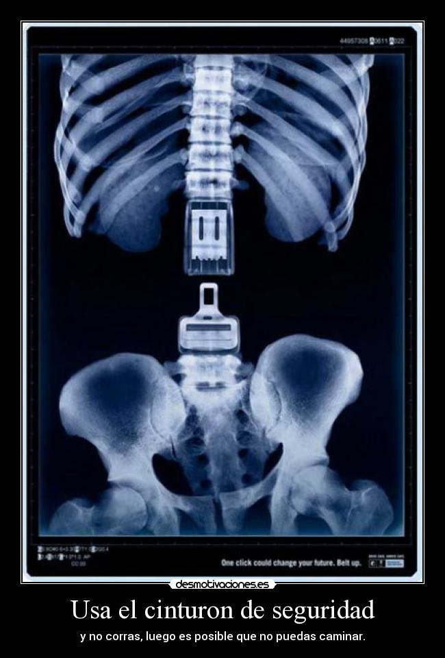 Usa el cinturon de seguridad - y no corras, luego es posible que no puedas caminar.