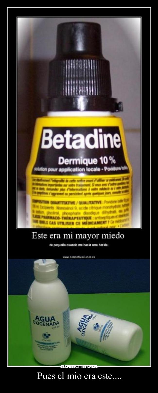 Pues el mio era este.... - 