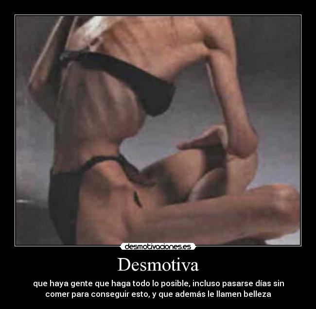 Desmotiva - que haya gente que haga todo lo posible, incluso pasarse días sin
comer para conseguir esto, y que además le llamen belleza