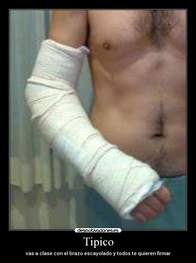 Tipico - vas a clase con el brazo escayolado y todos te quieren firmar