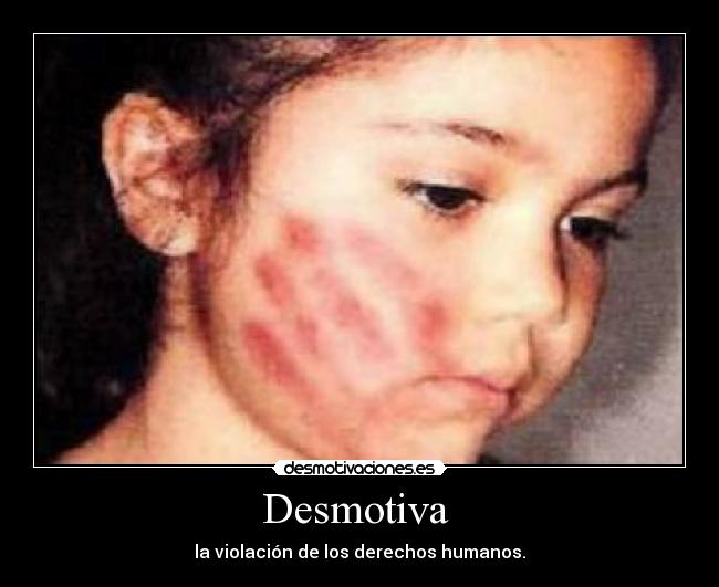 Desmotiva  - la violación de los derechos humanos.