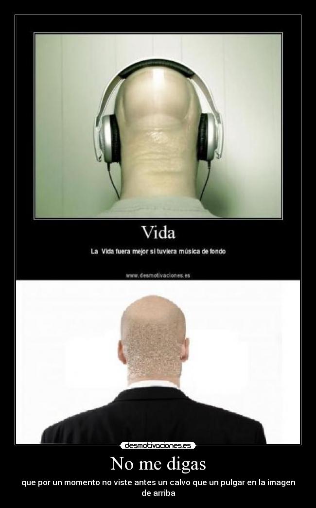 No me digas - que por un momento no viste antes un calvo que un pulgar en la imagen de arriba