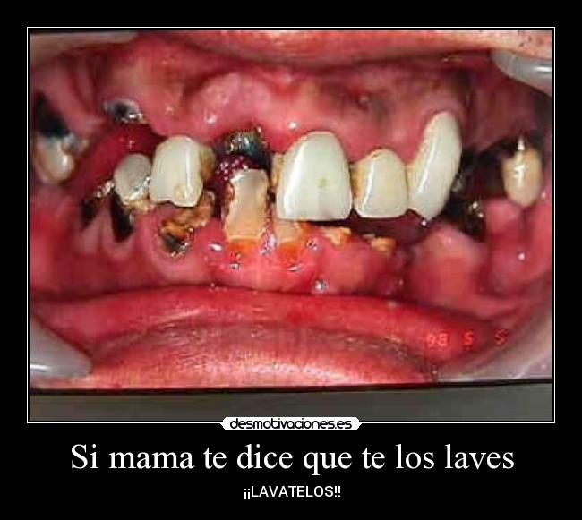 carteles caries desmotivaciones