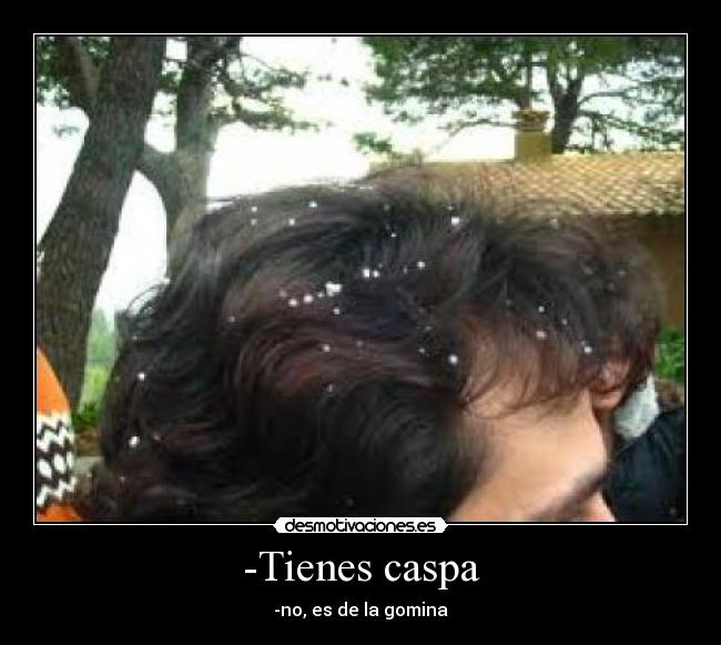 -Tienes caspa - -no, es de la gomina