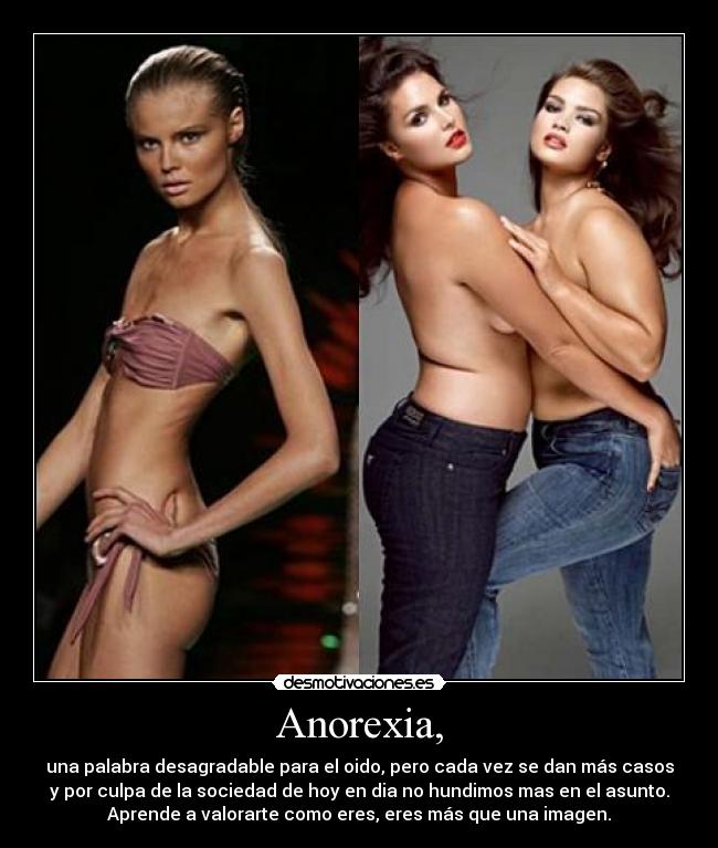 Anorexia, -