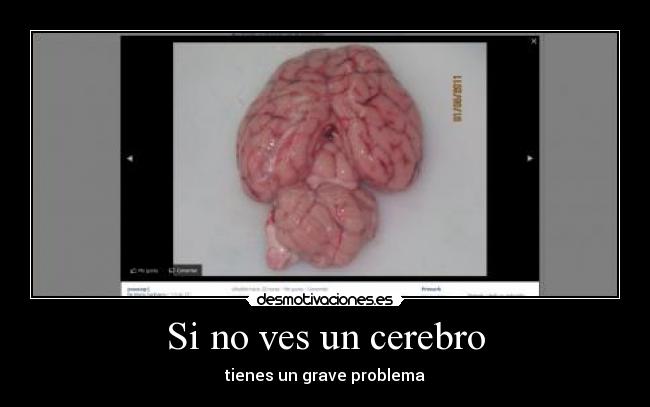 Si no ves un cerebro - tienes un grave problema