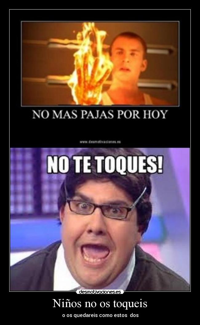 Niños no os toqueis - o os quedareis como estos dos