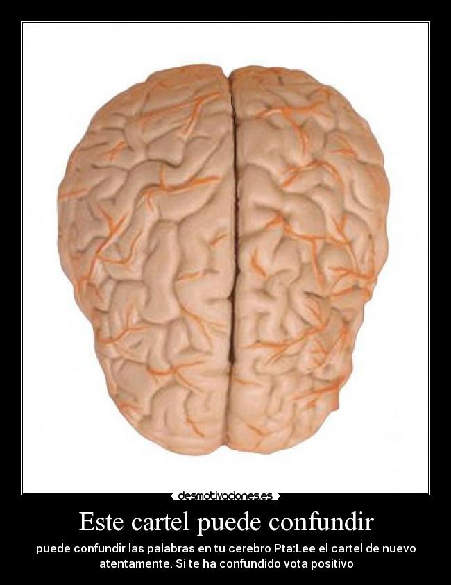 Este cartel puede confundir - puede confundir las palabras en tu cerebro Pta:Lee el cartel de nuevo
atentamente. Si te ha confundido vota positivo