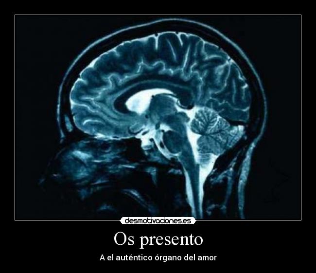 Os presento - 