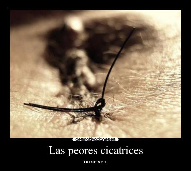 Las peores cicatrices -