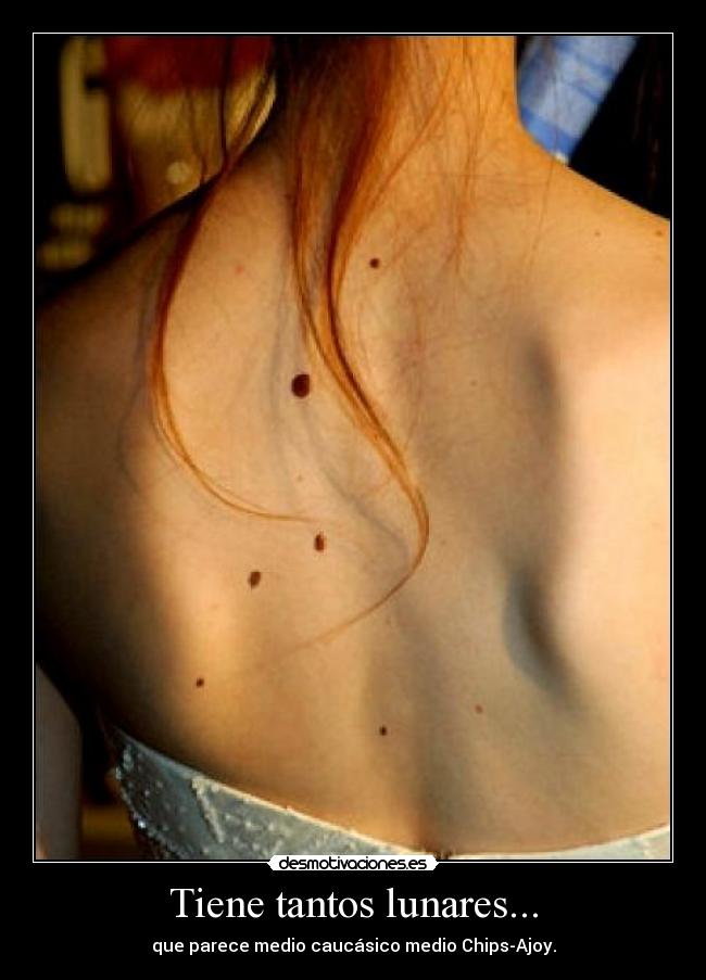 Tiene tantos lunares... - que parece medio caucásico medio Chips-Ajoy.