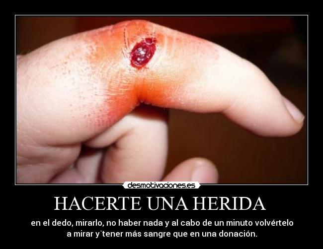 HACERTE UNA HERIDA  - 