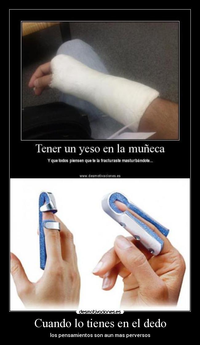 carteles yeso mano dedo fracturado masturbacion ano desmotivaciones