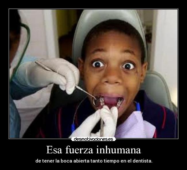 Esa fuerza inhumana - de tener la boca abierta tanto tiempo en el dentista.