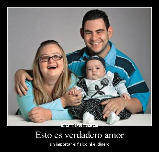 Esto es verdadero amor - sin importar el físico ni el dinero.