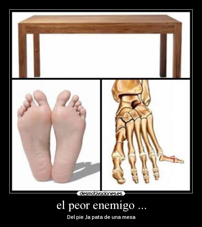 el peor enemigo ... -