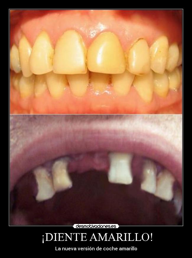 ¡DIENTE AMARILLO! - La nueva versión de coche amarillo