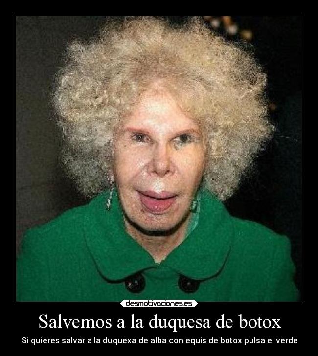 Salvemos a la duquesa de botox - Si quieres salvar a la duquexa de alba con equis de botox pulsa el verde