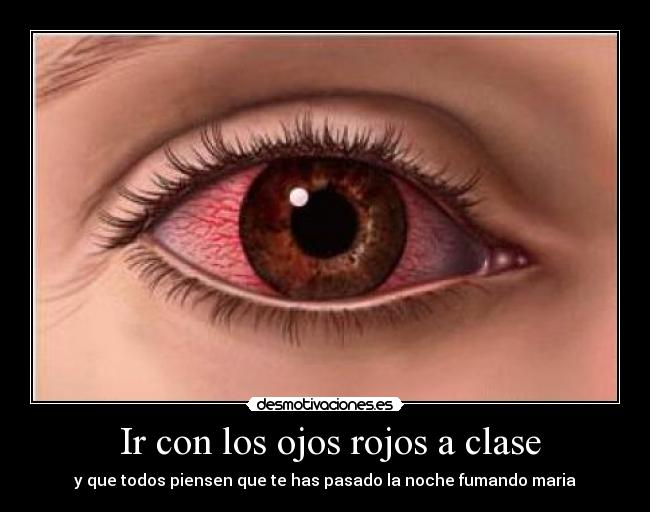 Ir con los ojos rojos a clase - 