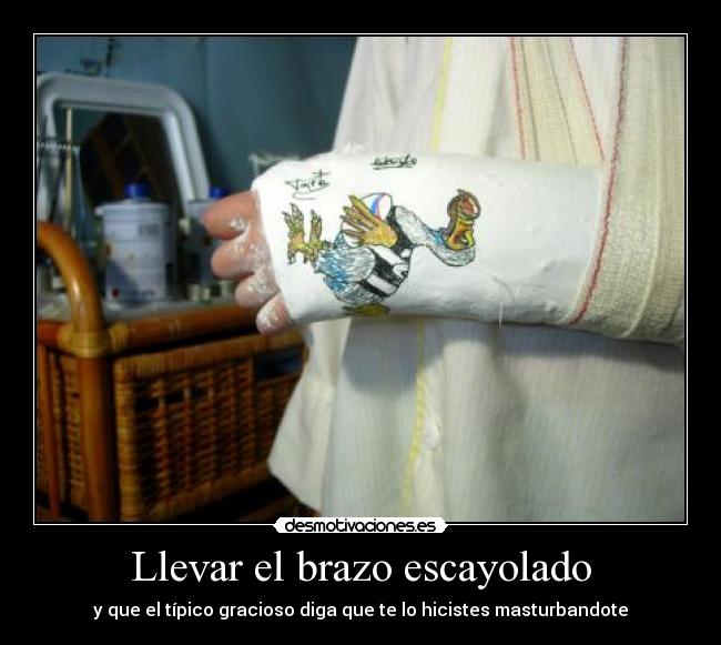 Llevar el brazo escayolado - y que el típico gracioso diga que te lo hicistes masturbandote