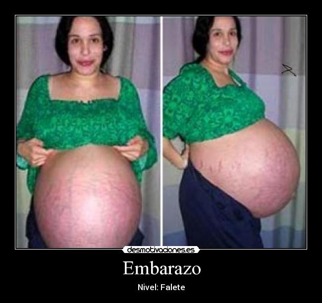 Embarazo -