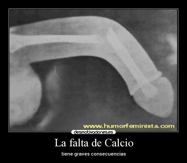 La falta de Calcio - 