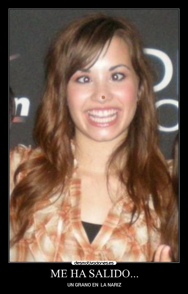 ME HA SALIDO... - UN GRANO EN LA NARIZ