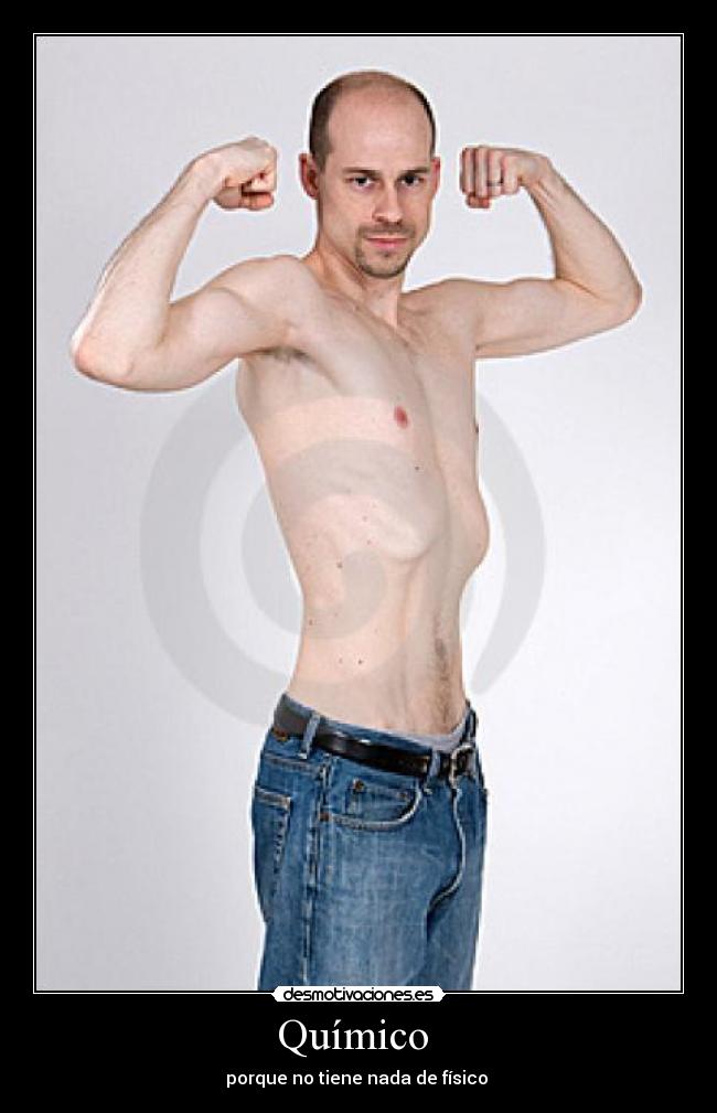Químico - porque no tiene nada de físico