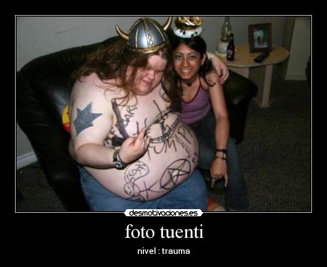 foto tuenti - nivel : trauma