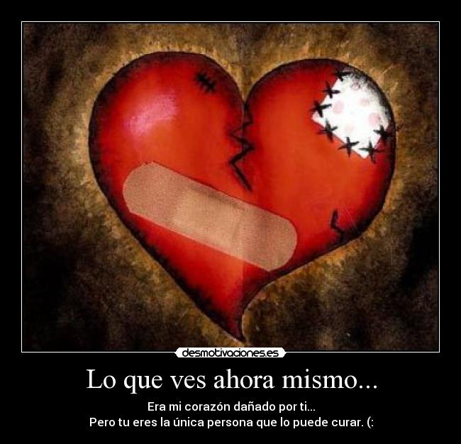 Lo que ves ahora mismo... - Era mi corazón dañado por ti...
Pero tu eres la única persona que lo puede curar. (:
